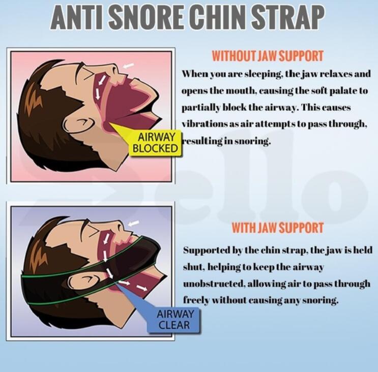 Neoprene Anti Snore Stop Snoring Chin Strap Belt Anti Apnea Aid for Snoring UK