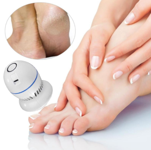 Callus Remover - Foot Callus Remover