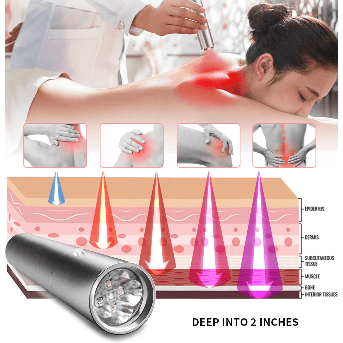 Red and Blue Light Phototherapy Therapy