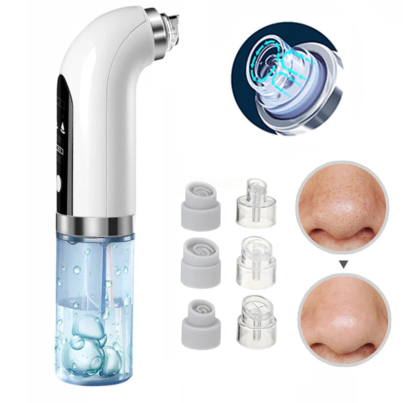 Professional Nose Blackhead Remover Vacuum - Deep Cleansing with Suction Technology