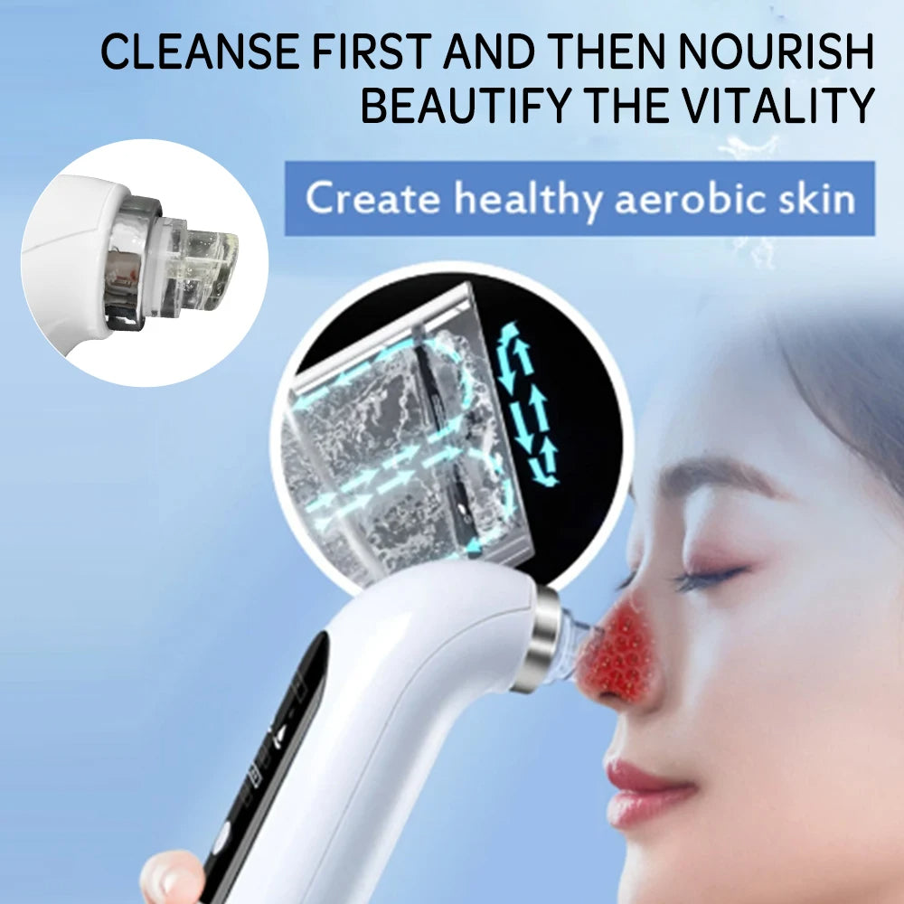 Professional Nose Blackhead Remover Vacuum - Deep Cleansing with Suction Technology