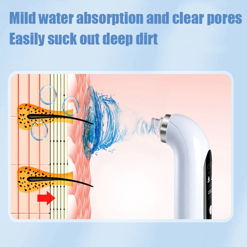 Professional Nose Blackhead Remover Vacuum - Deep Cleansing with Suction Technology