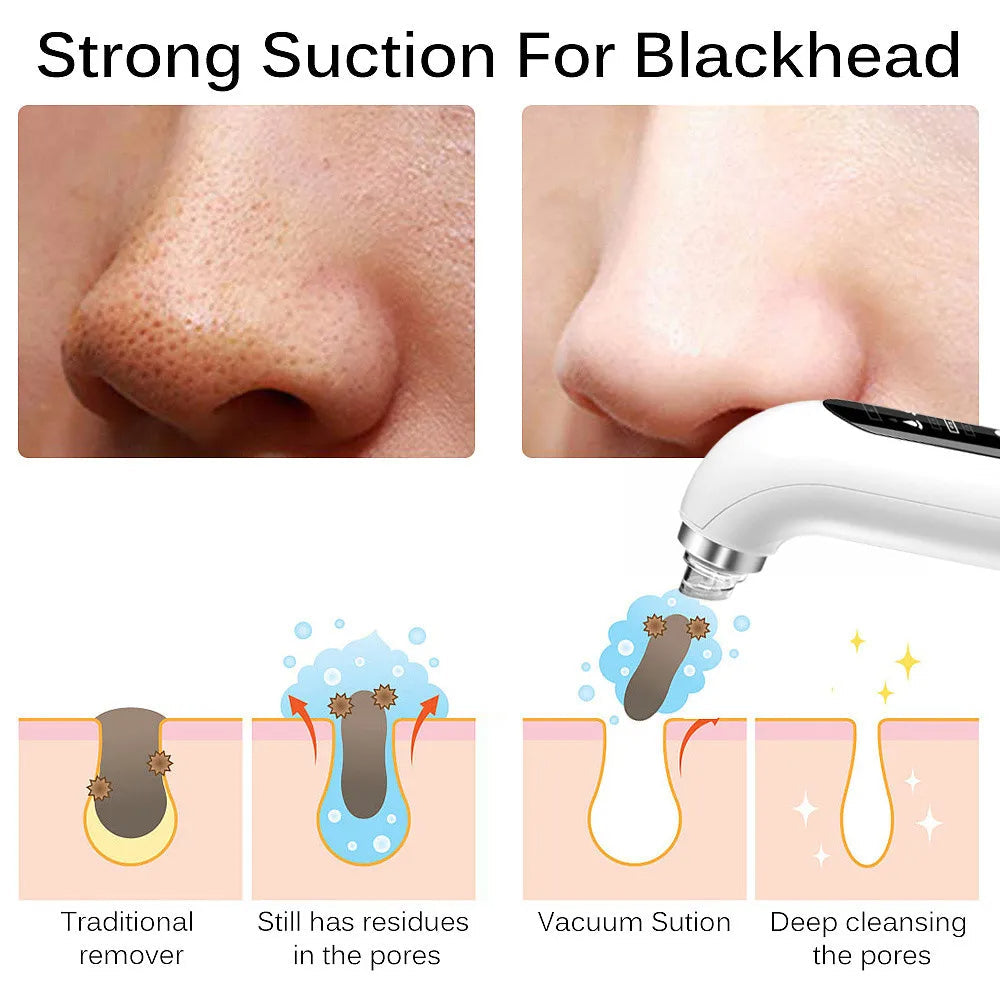 Professional Nose Blackhead Remover Vacuum - Deep Cleansing with Suction Technology